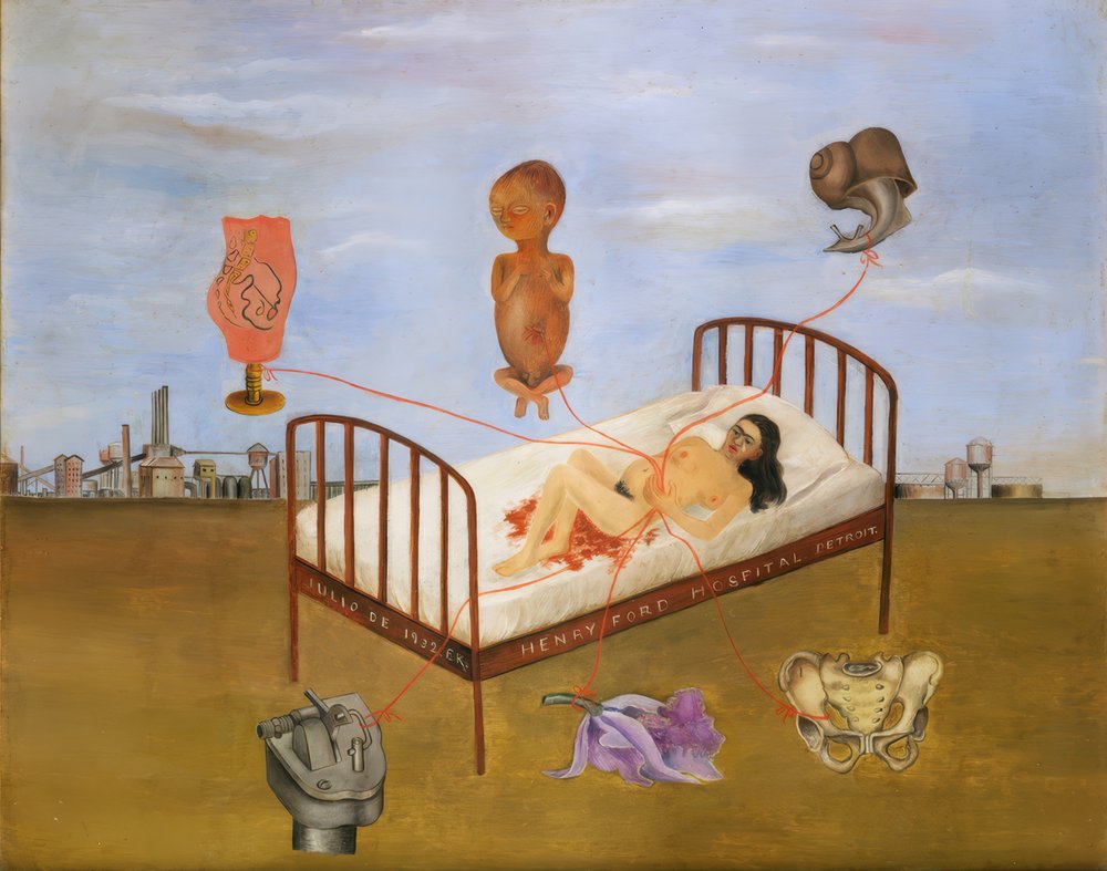 Hospital Henry Ford o La cama voladora de Frida Kahlo