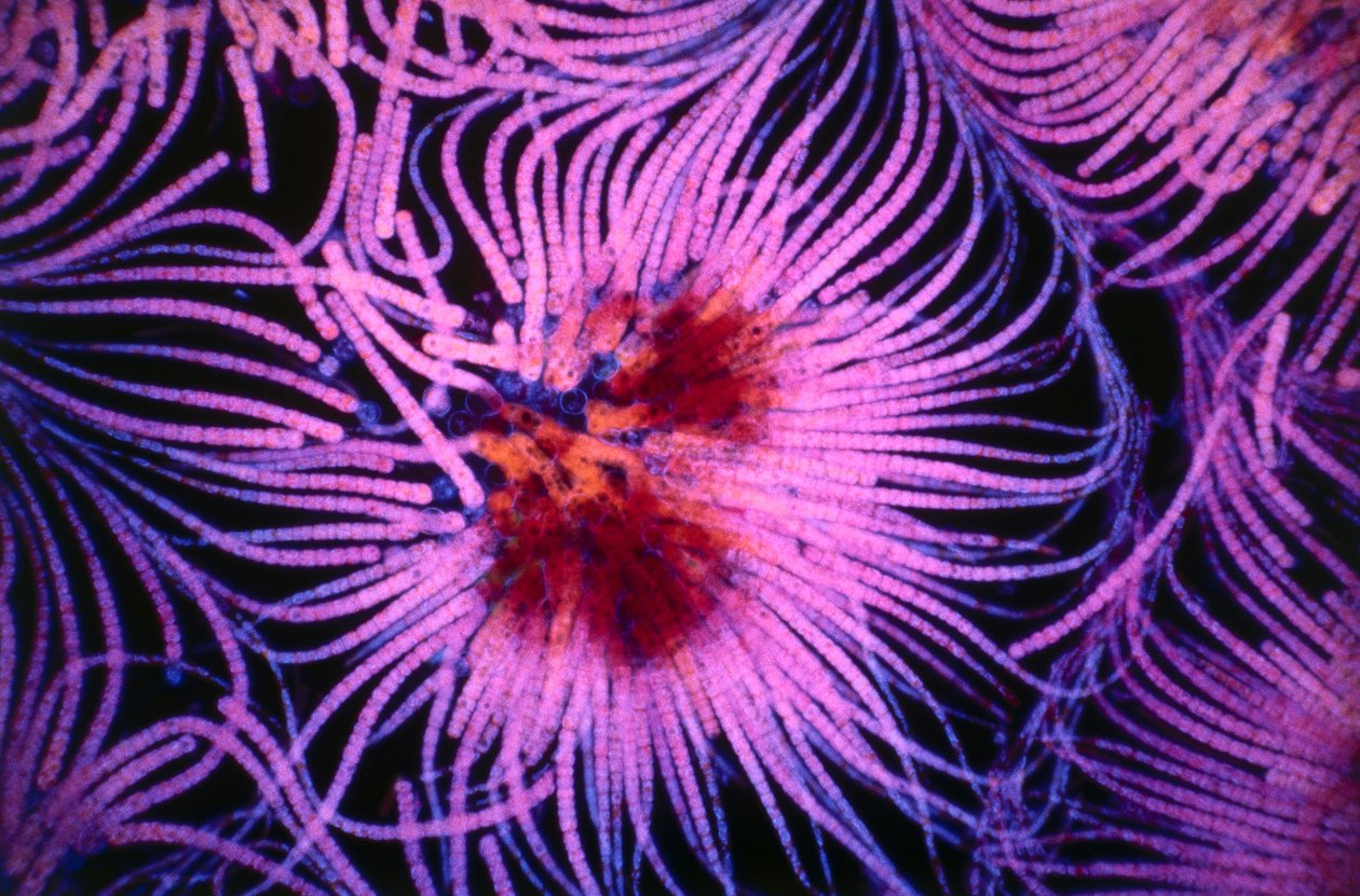 Diapositiva que muestra un grupo de organismos unicelulares llamados cianobacterias de Unknown