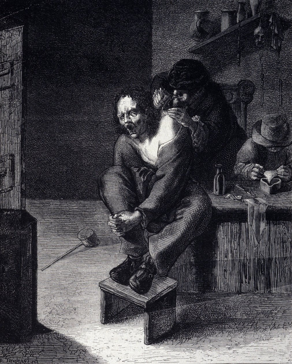 La operación quirúrgica (grabado) de Adriaen (after) Brouwer