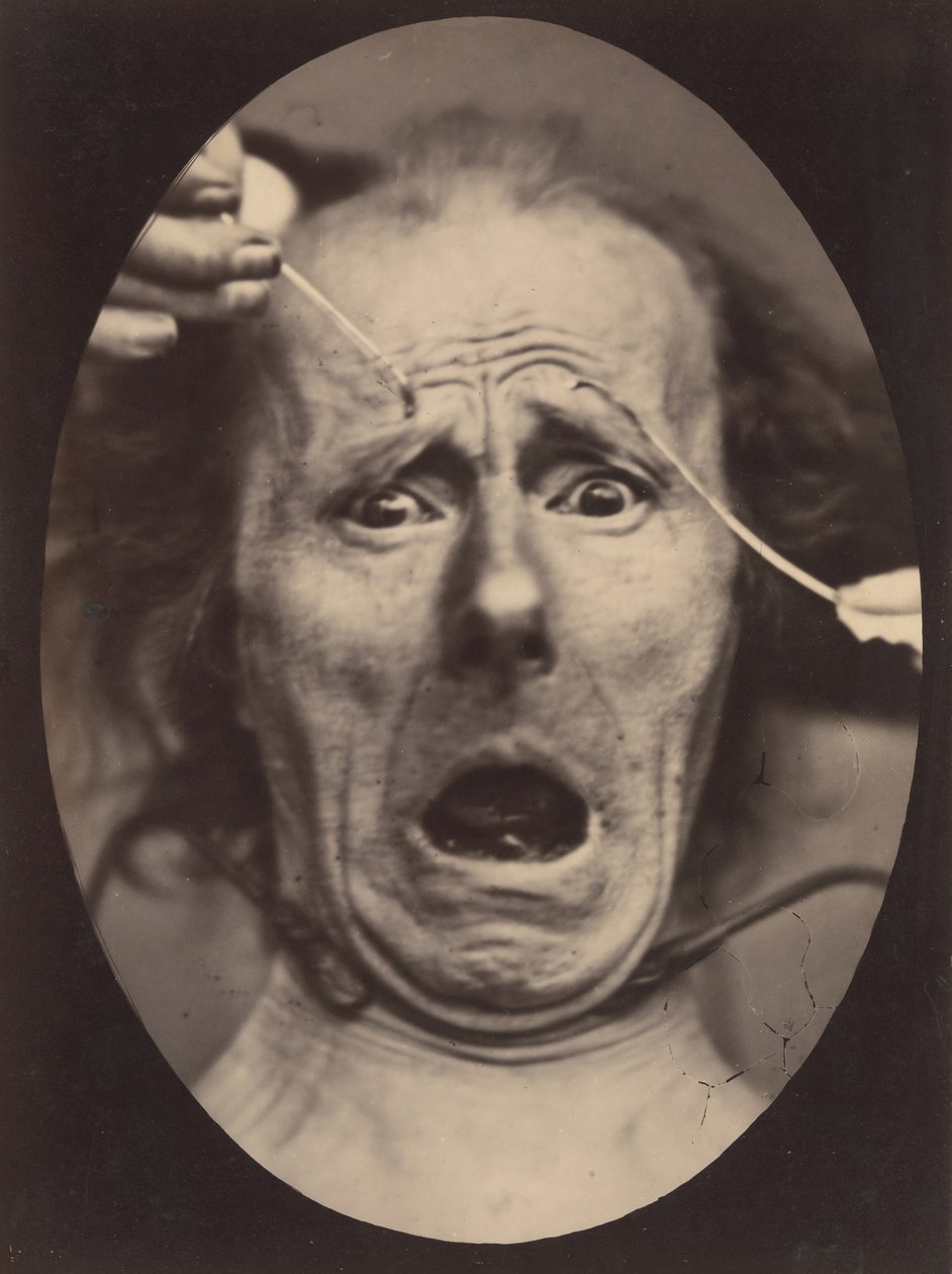 Electro-Fisiología, Figura 64, 1854-56, impreso en 1862 de Adrien Alban Tournachon