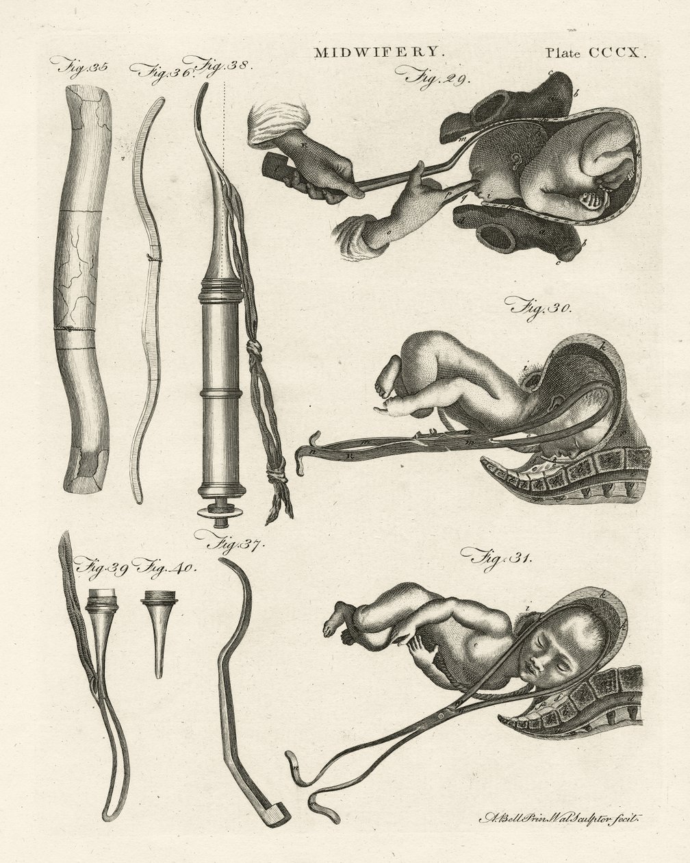 Obstetricia, ilustración de 