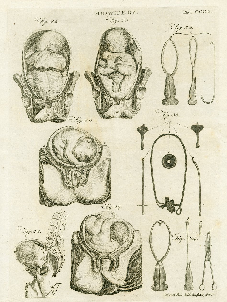 Obstetricia, ilustración de 