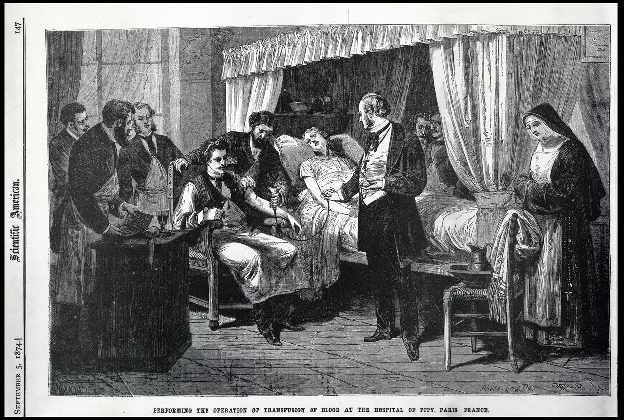 Realizando la operación de la transfusión de sangre en el Hospital de la Piedad, París, Francia, ilustración del American Scientist de American School