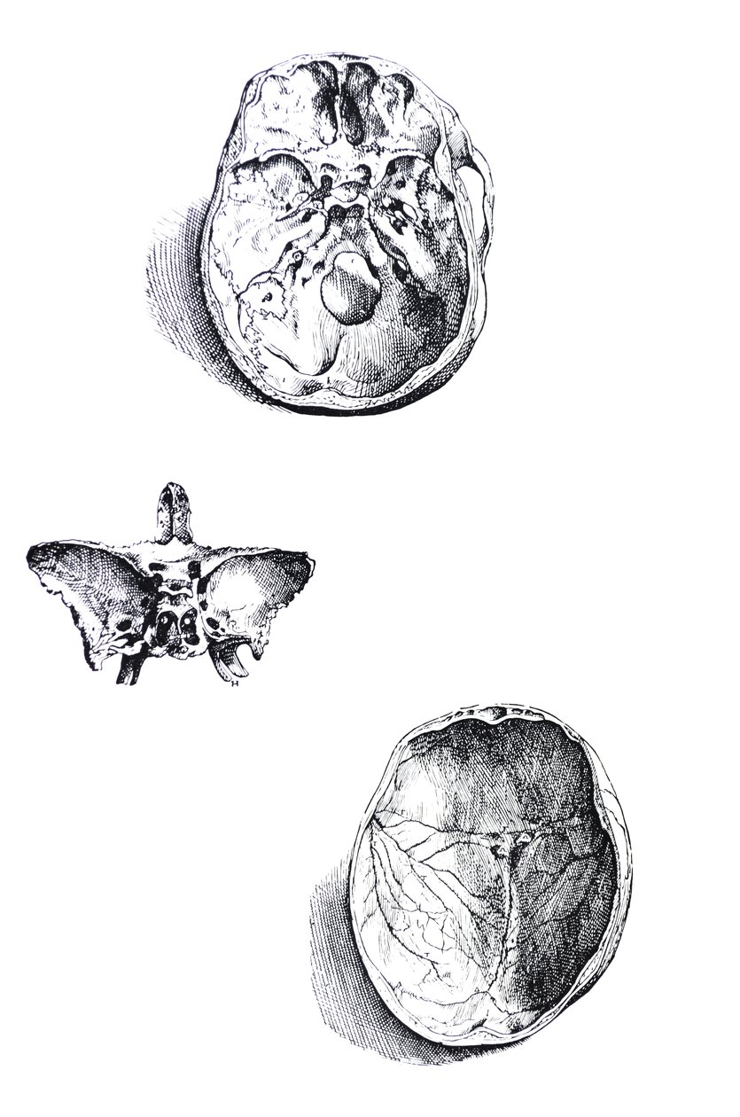 Las Placas del Primer Libro de De Humani Corporis Fabrica de Andreas Vesalius