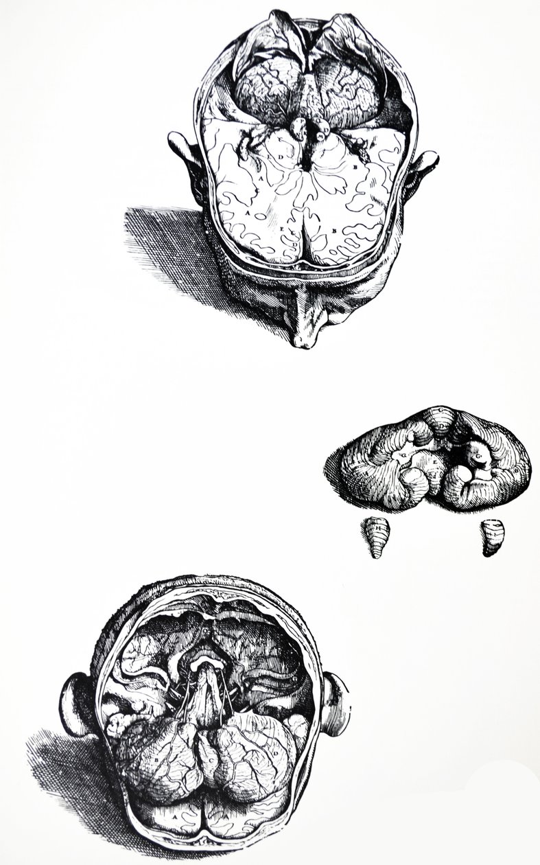 Las Placas del Séptimo Libro de De Humani Corporis Fabrica de Andreas Vesalius