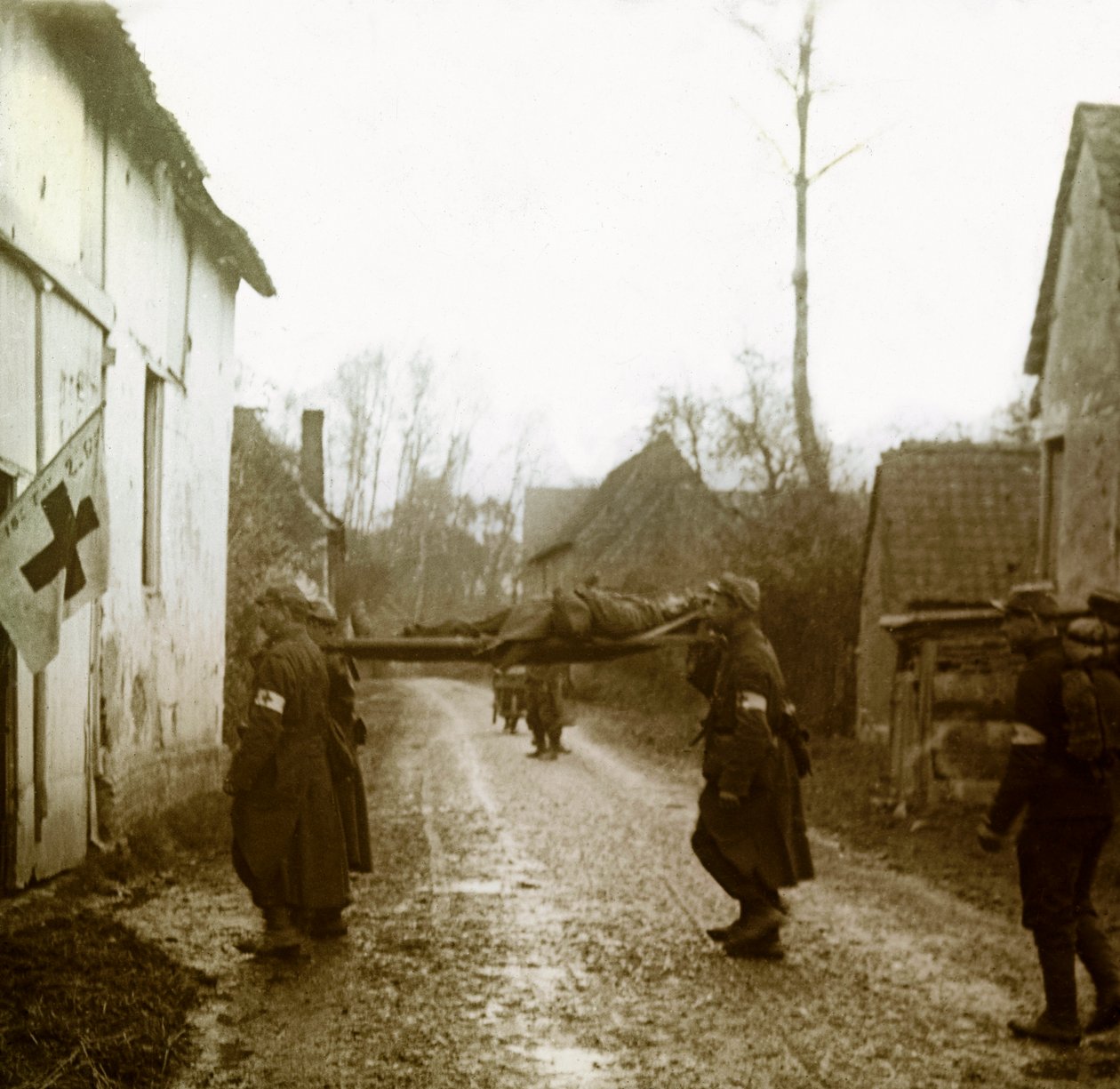 Fotografía - Placa de vidrio estereoscópica sobre la Primera Guerra Mundial: Heridos llegando a la estación de emergencia de Anonymous Anonymous