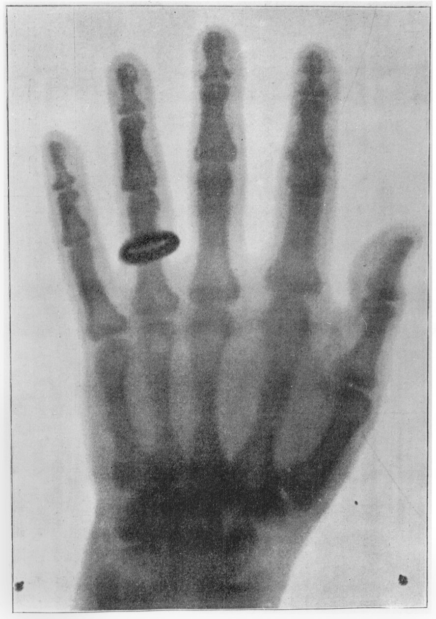 Radiografía de la mano izquierda de Anna Bertha Ludwig, esposa de Röntgen de Carl August Voller