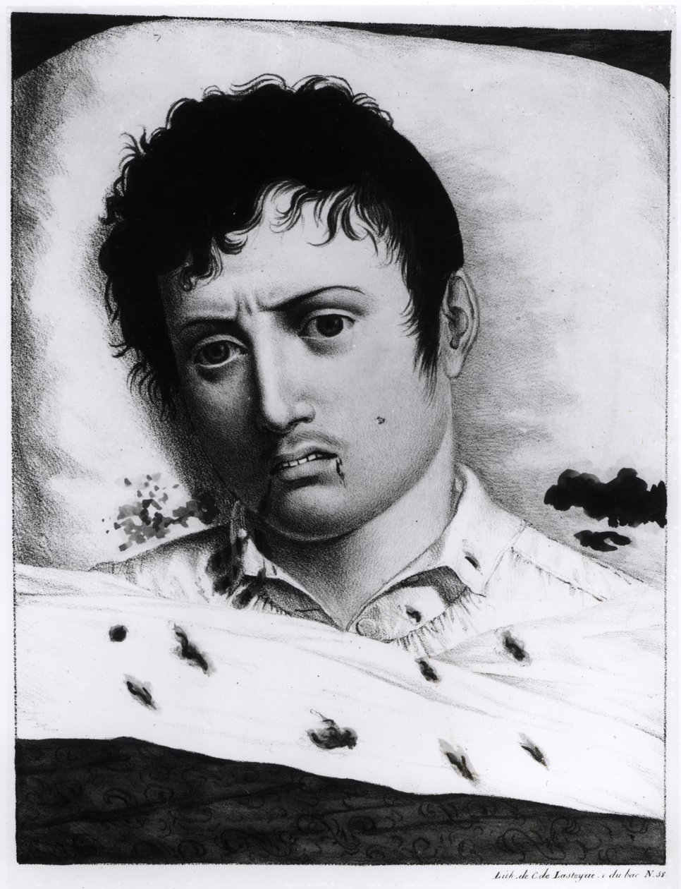Observación de la fiebre amarilla, c.1819 de Charles Lasteyrie du Saillant