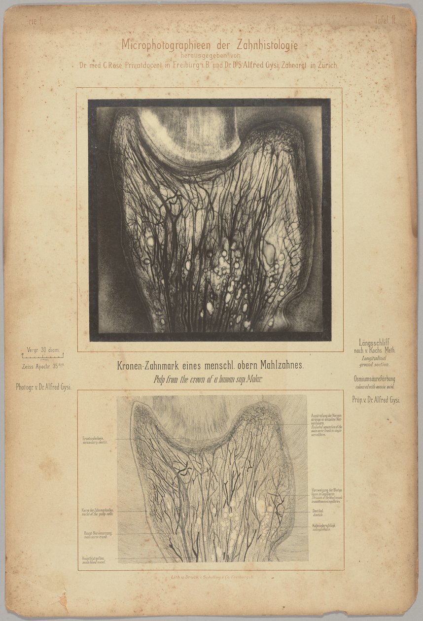 Pulpa de la corona de un molar superior humano de Dr. Alfred Gysi