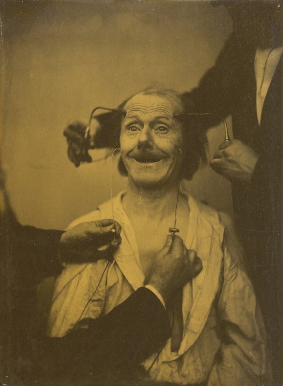 Una falsa, incompleta expresión de sorpresa agradable o admiración, 1854-1856, impreso 1862 de Duchenne de Boulogne