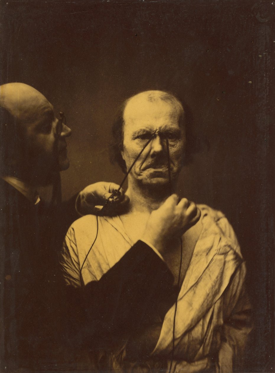 Agresión, maldad, 1854-1856, impreso 1862 de Duchenne de Boulogne