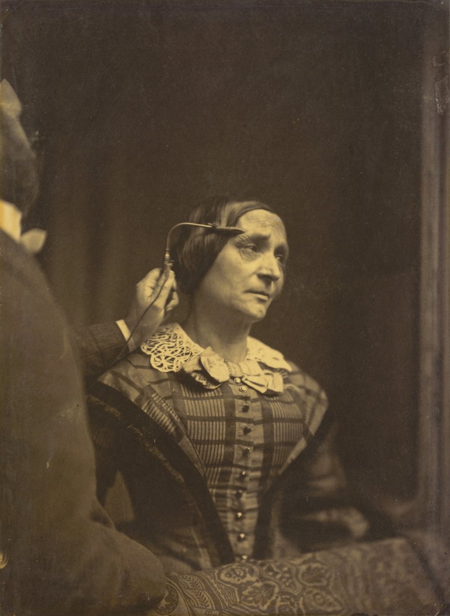 Atención, mirada atenta a la izquierda, atención dolorosa a la derecha, 1854-1856, impreso en 1862 de Duchenne de Boulogne