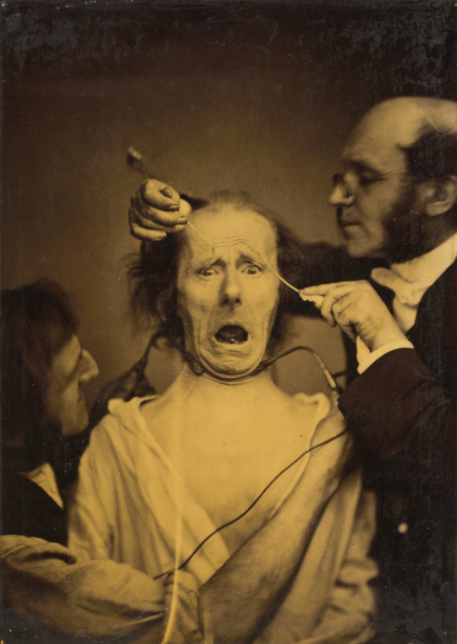 Terror mezclado con dolor, tortura, 1854-1856, impreso 1862 de Duchenne de Boulogne