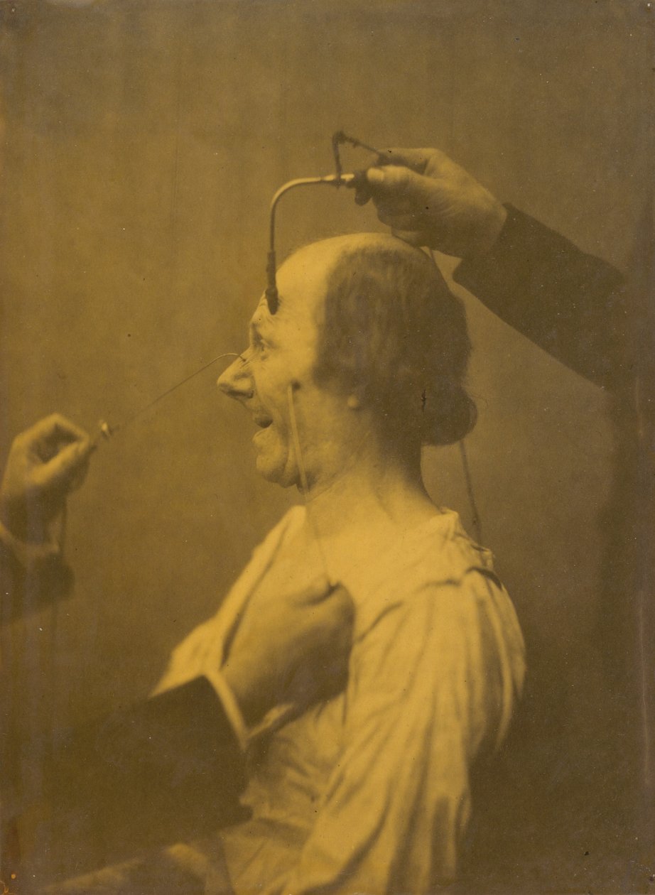 La atención atraída por un objeto que provoca ideas y deseos lascivos, 1854-1856 de Duchenne de Boulogne