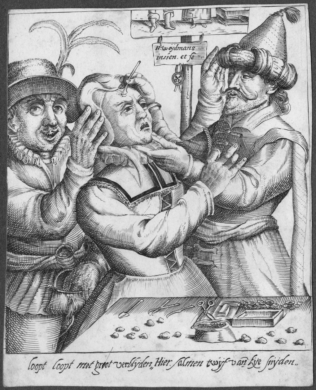 Trepanning, grabado por H. Weydmans (siglo XVI) de Dutch School