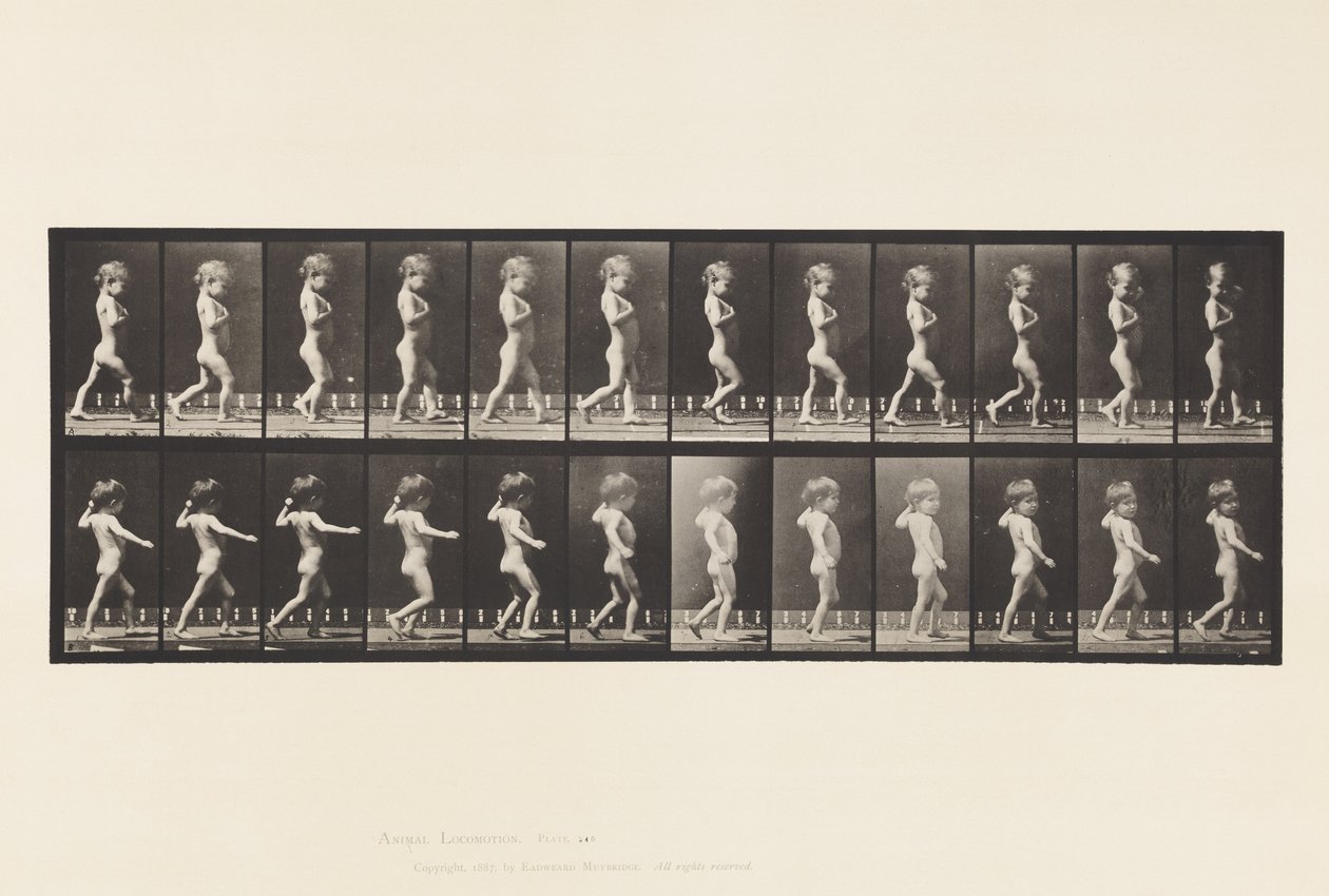 Placa 540. A, Piernas arqueadas; niño; B, Caries espinal; niña caminando de Eadweard Muybridge