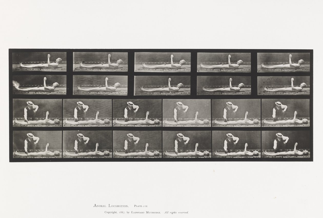 Placa 556. Corea local; A, B, Mientras yace de Eadweard Muybridge
