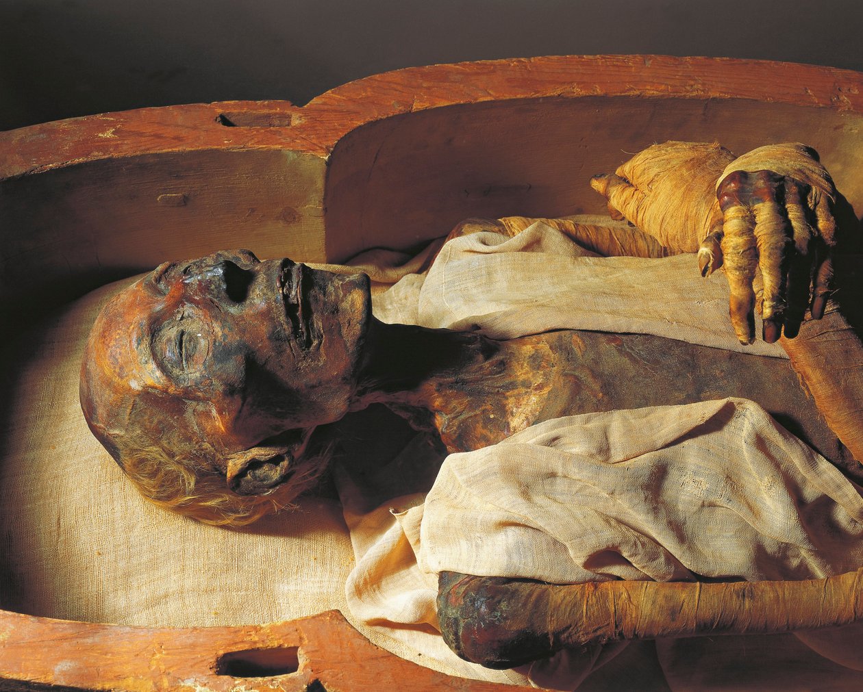 Momia de Ramsés II (hacia 1297-1213 a.C.), detalle de Egyptian 19th Dynasty