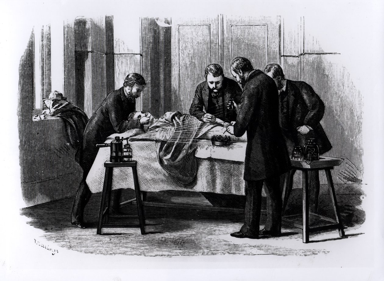 Cirugía Antiséptica, 1882 de English School