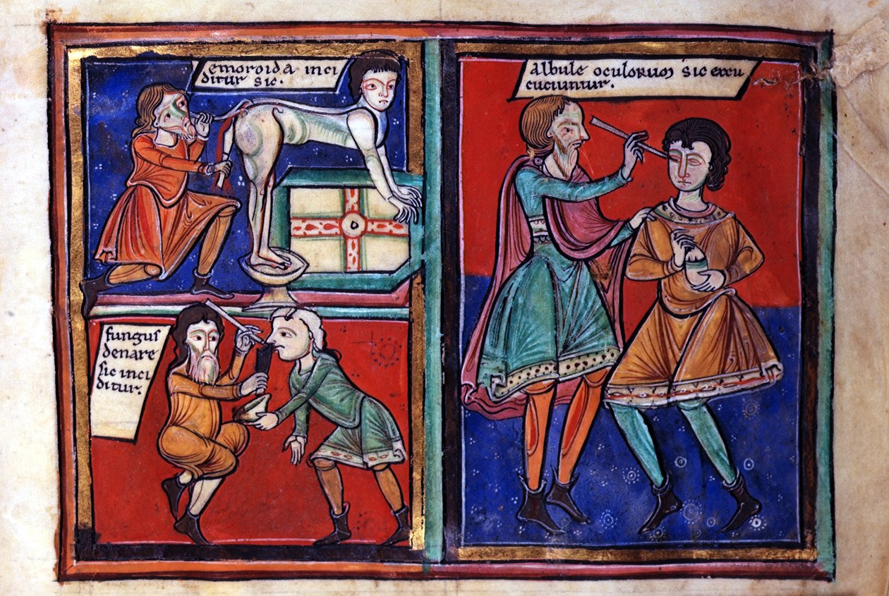 Sloane Ms 1975 fol.93 Operaciones médicas de English School