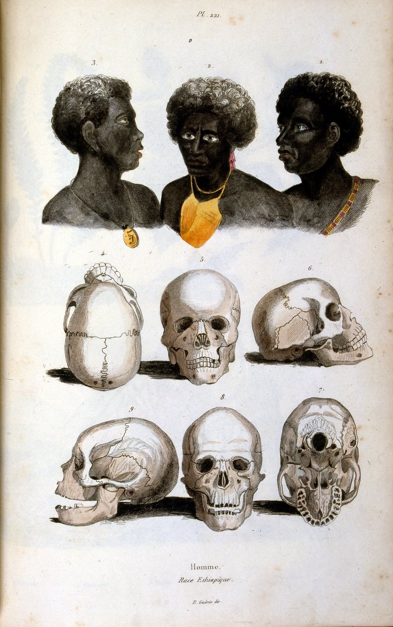 Ilustración antropológica de la raza etíope de Felix-Edouard Guerin