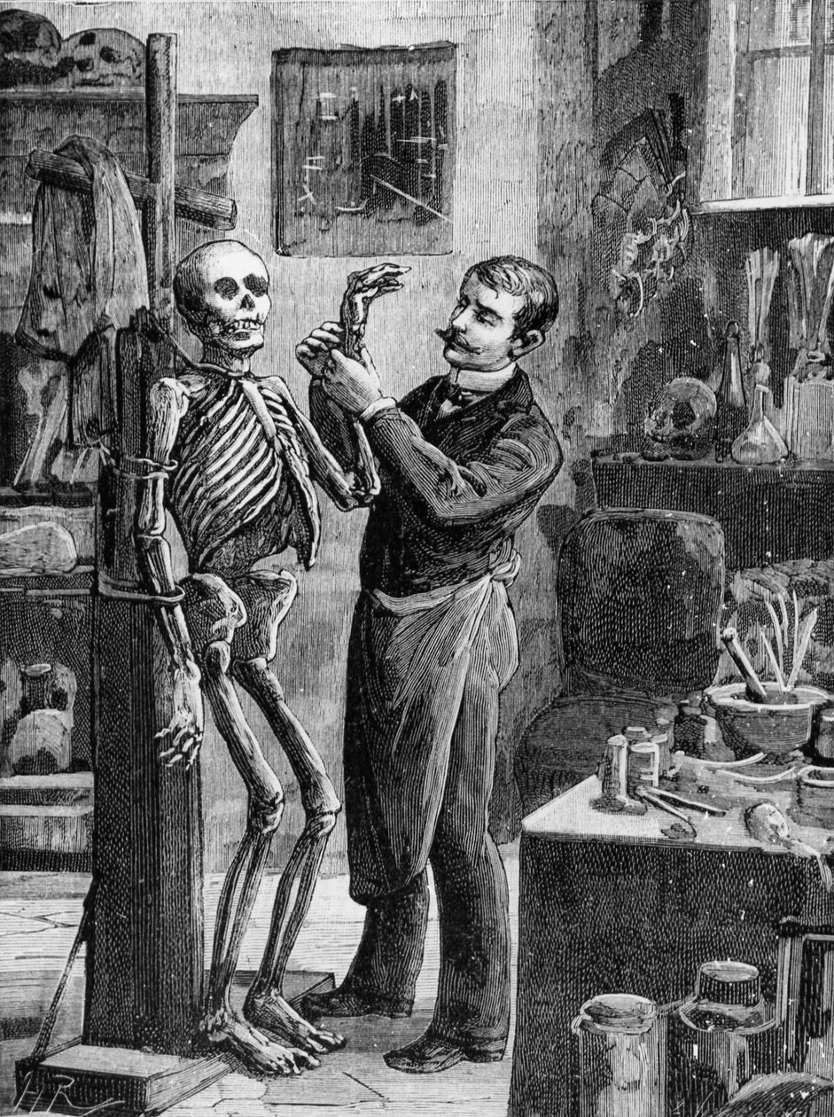 Caso Gouffé: La reconstrucción imaginaria del cadáver Gouffé por el Dr. Lacassagne - en "La Malle Sanglante", ed. A. Fayard, París, s.f. - París, B.H.V.P.D. de French School
