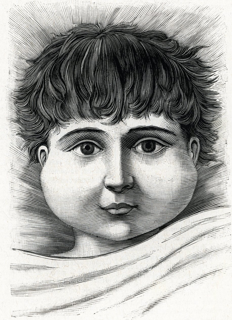 Niño con paperas (grabado) 1888 de French School