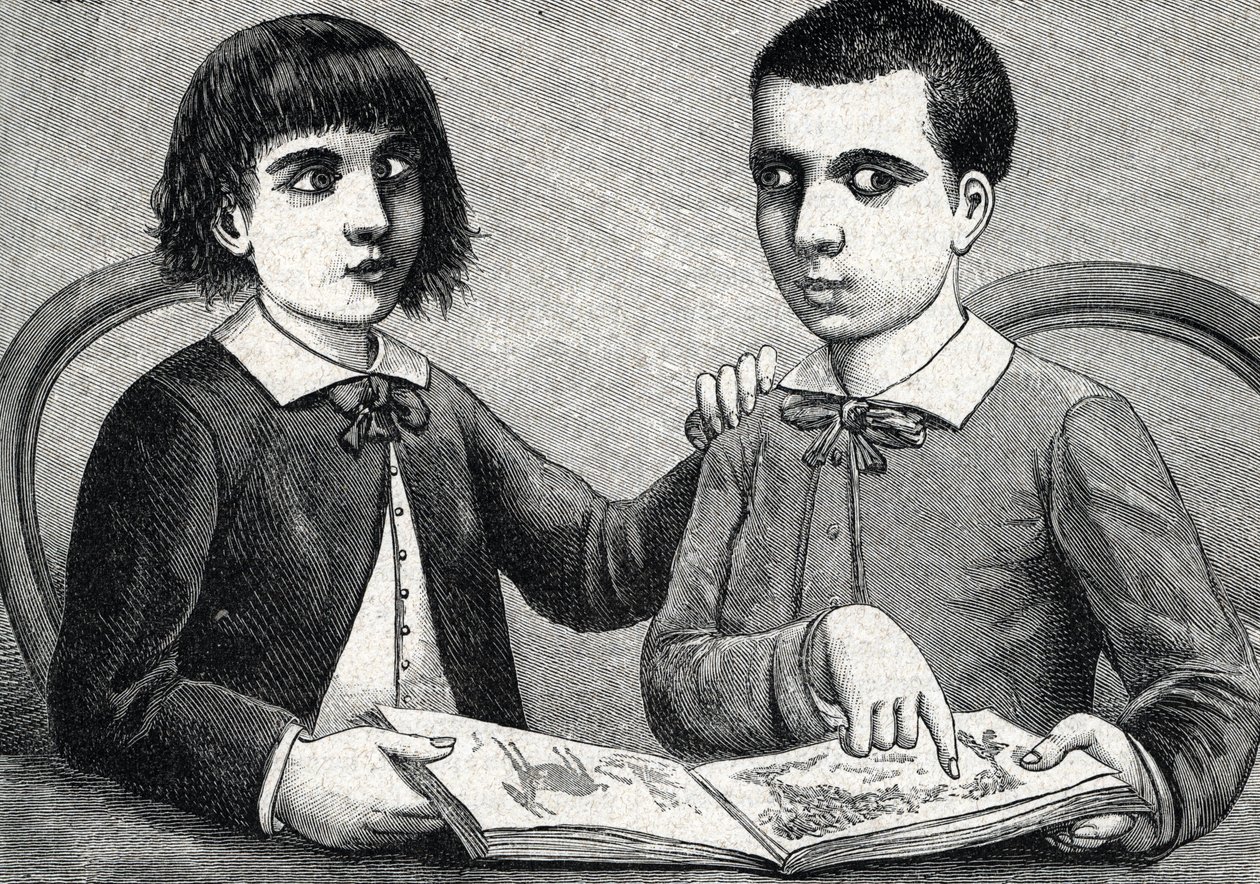 Niños con estrabismo convergente y divergente o ojos cruzados (grabado) 1888 de French School
