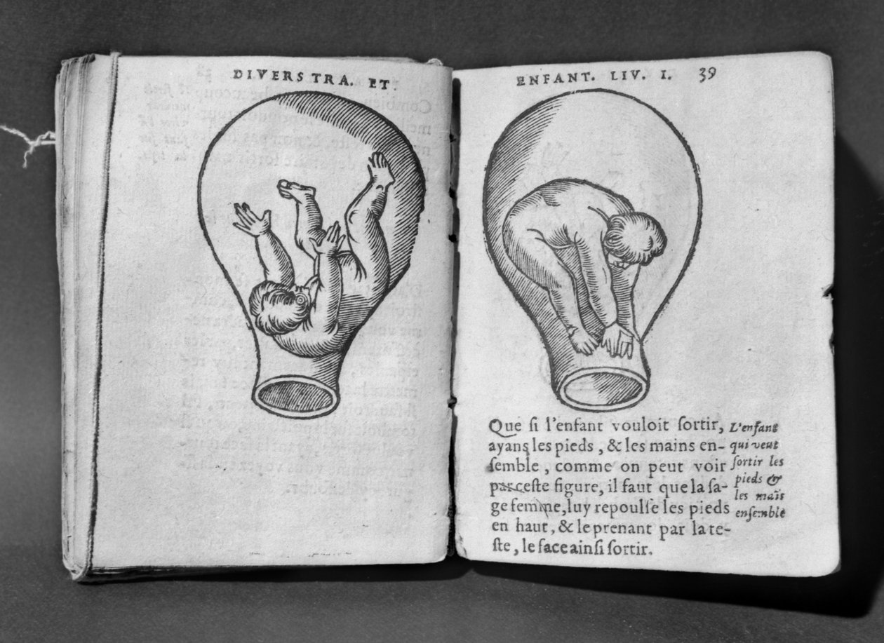 Feto en el útero, ilustración del llamado manuscrito Rhodion de French School