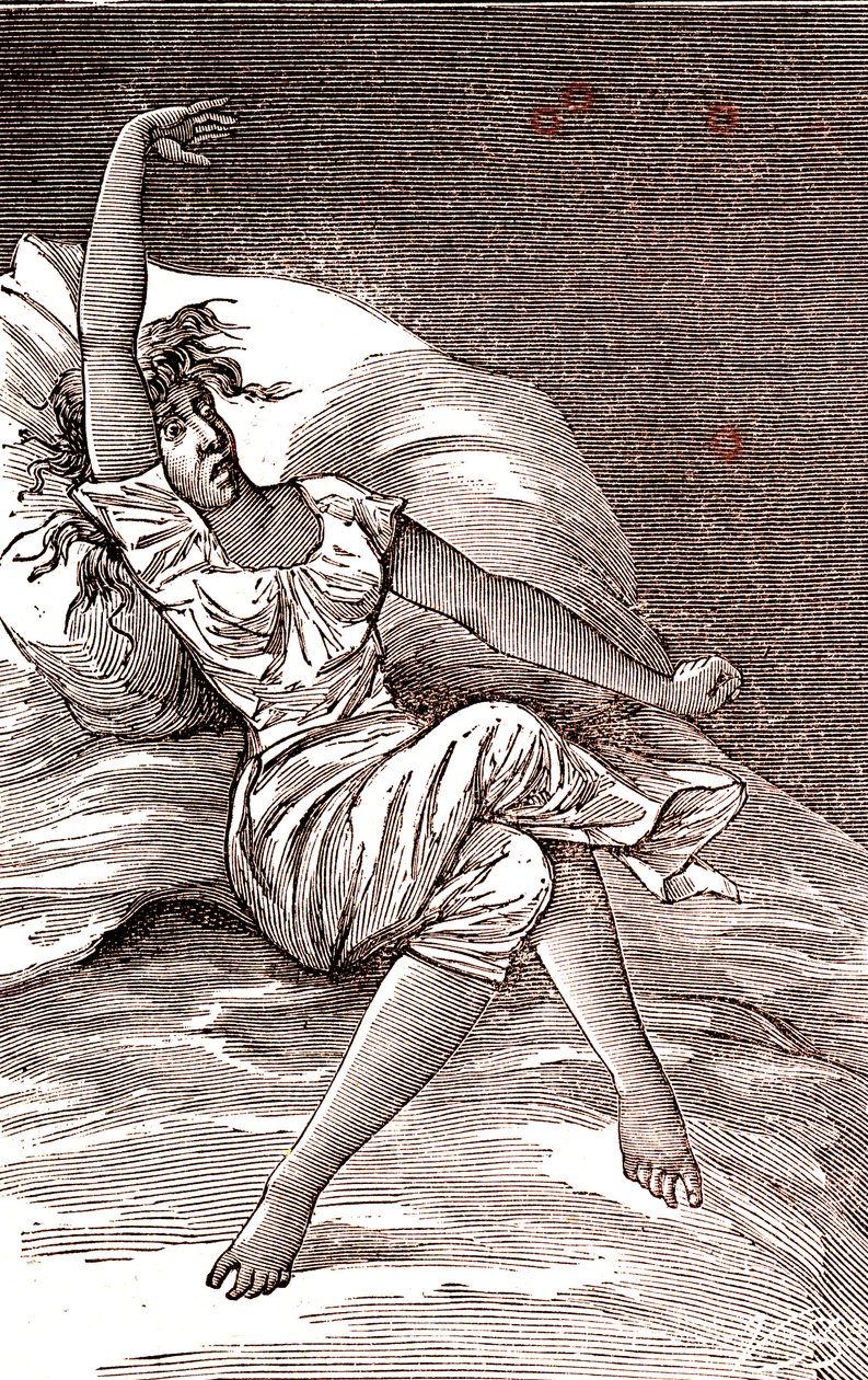 Dolores de cabeza, melancolía e histeria, ansiedad. 1887 (grabado) de French School