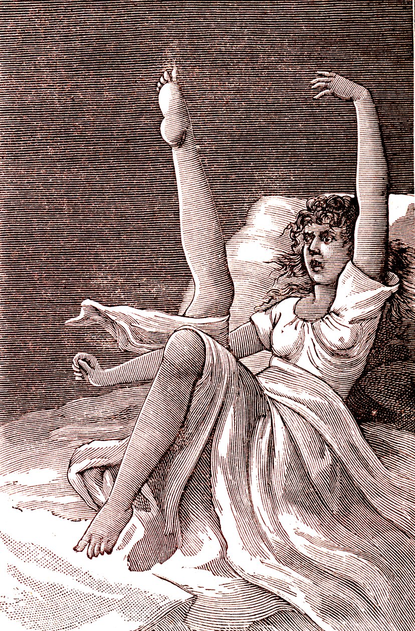 Histeria, fenómeno extremadamente mental, psicosis y psiconeurosis.1887 (grabado) de French School