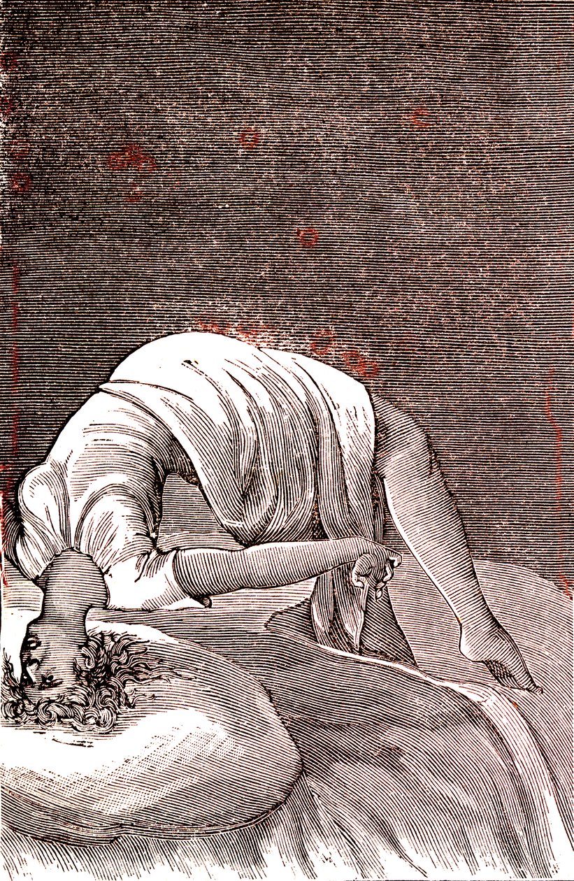 Histeria, trastorno mental y nervioso, derivado de una ansiedad intensa. 1887 (grabado) de French School