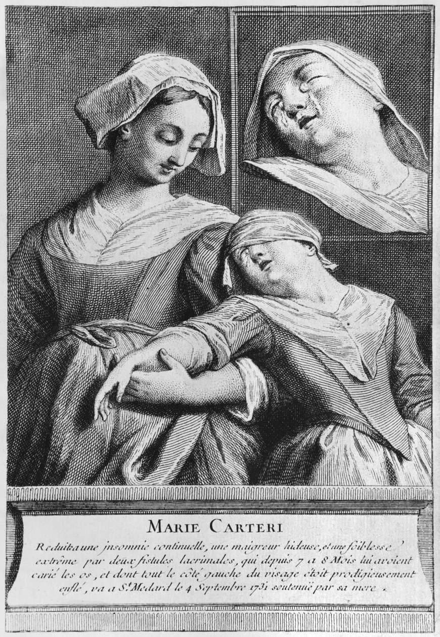 Curación milagrosa de una mujer ciega, Marie Carteri, en la tumba del diácono François de Paris en el cementerio parroquial Saint-Médard en París de French School