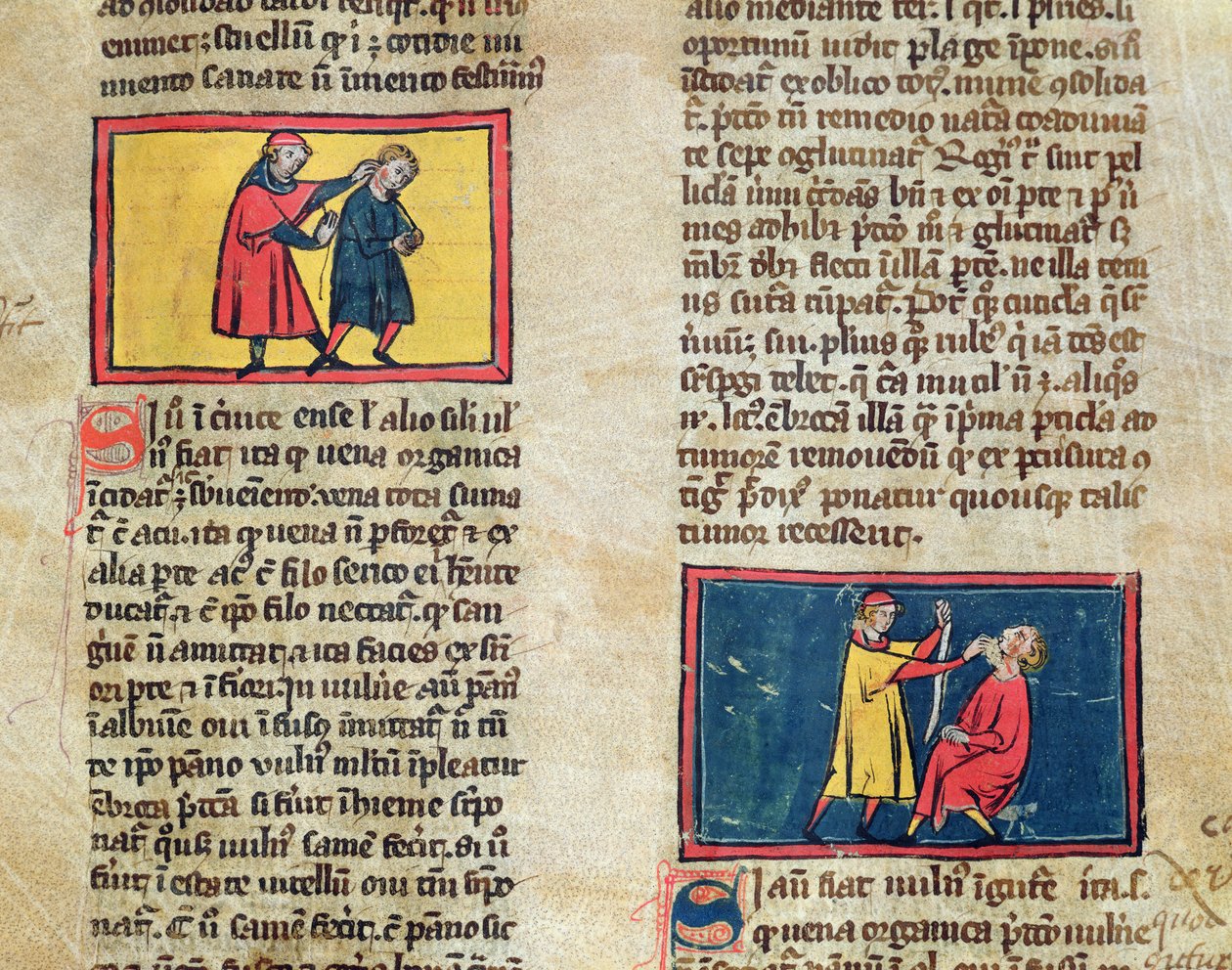 Doctores y pacientes, de una edición del Libro de Cirugía de Rogier de Salerne de French School