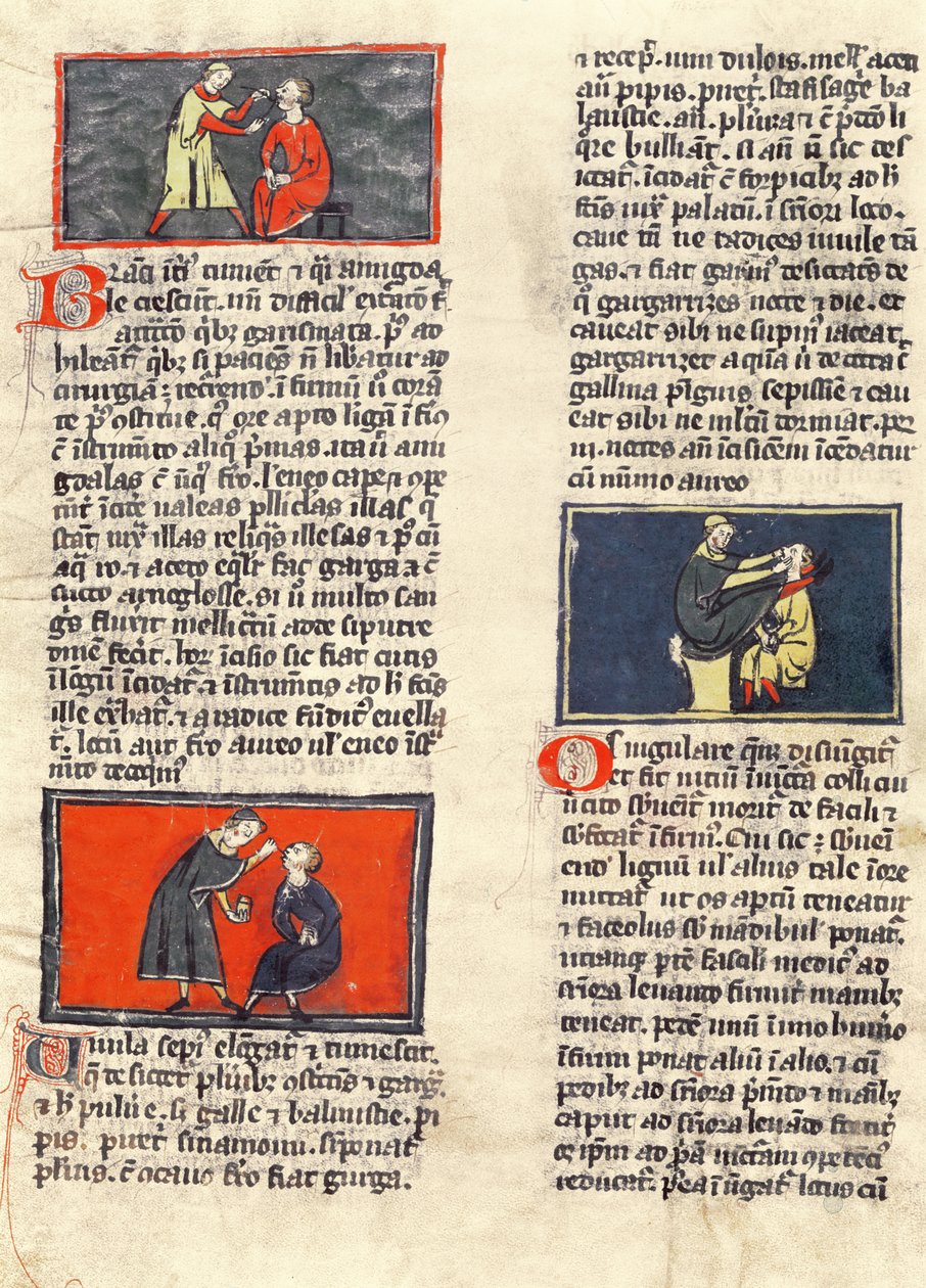 Ms H 89 fol.16v Cirugía dental, de una edición del 