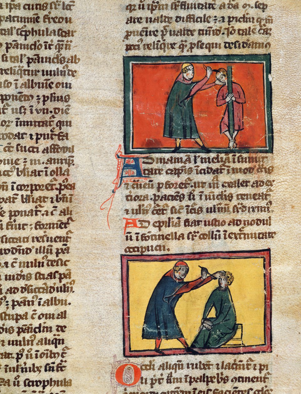 Ms H 89 fol.3 Doctores tratando a los enfermos, de una edición del Libro de Cirugía por Rogier de Salerne de French School
