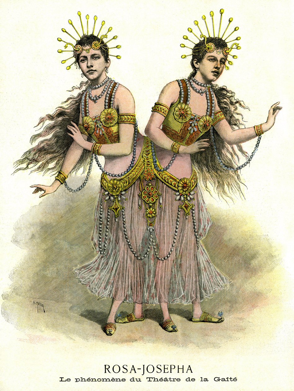 Fenómeno en espectáculo : Rosa-Josepha, hermanas-siamoises presentadas en el teatro de la Gaite de París en 1891 (impresión) de French School