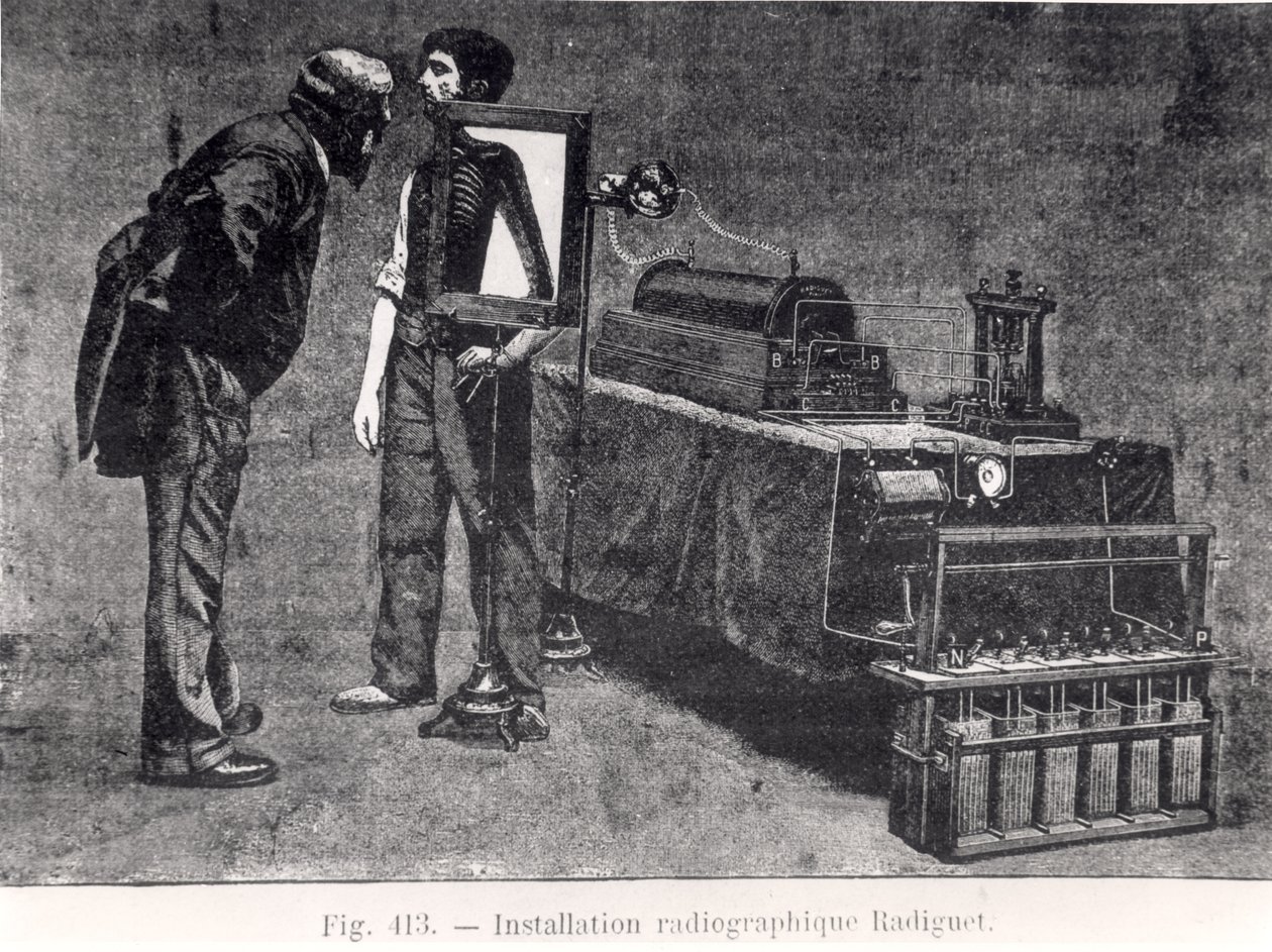 Máquina de rayos X Radiguet de French School