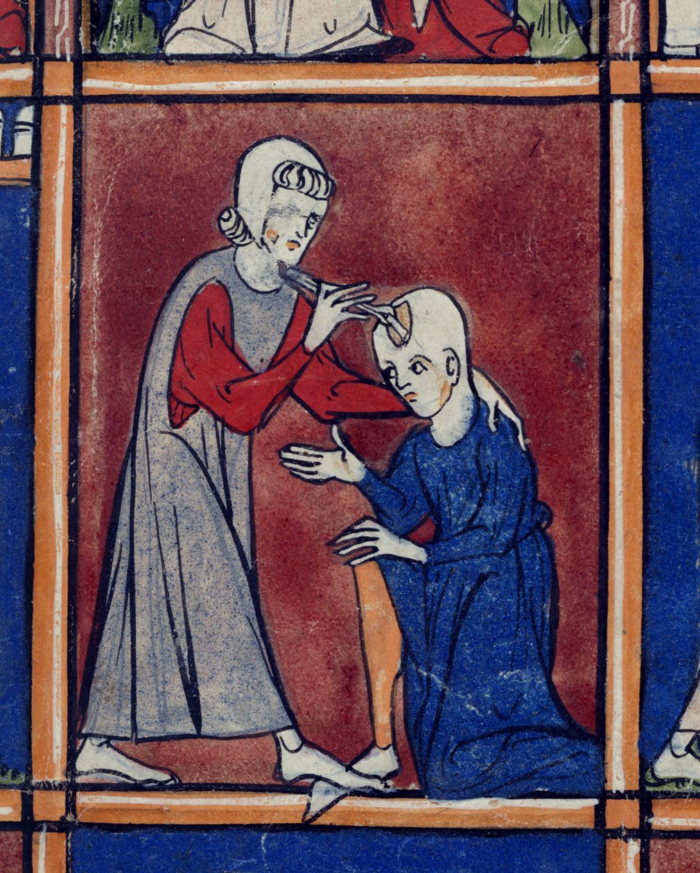 Sloane 1977 f.2 Operación en el cráneo de un paciente, ilustración de 