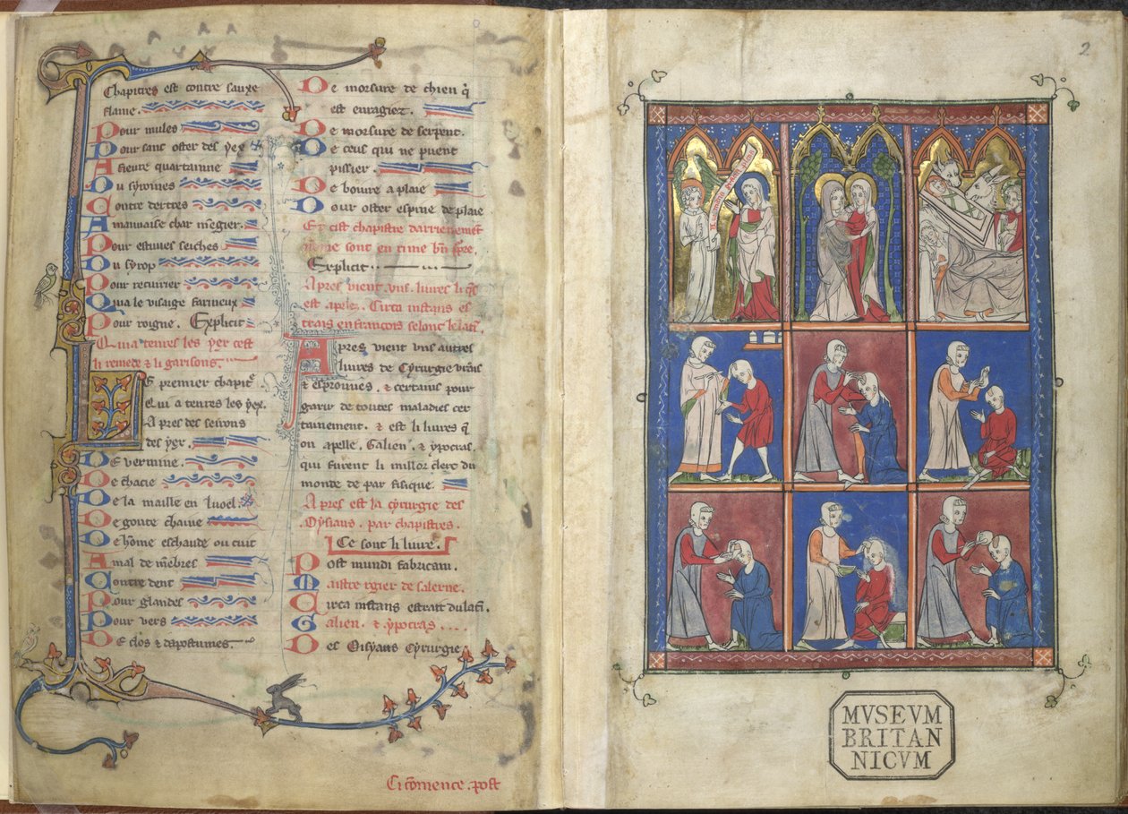 Sloane 1977,f.2 La Chirurgia: escenas bíblicas y médicas de French School