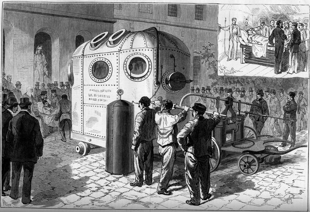 La campana neumática utilizada para anestesiar a los pacientes durante las operaciones quirúrgicas. Hospital Saint Louis en París de French School