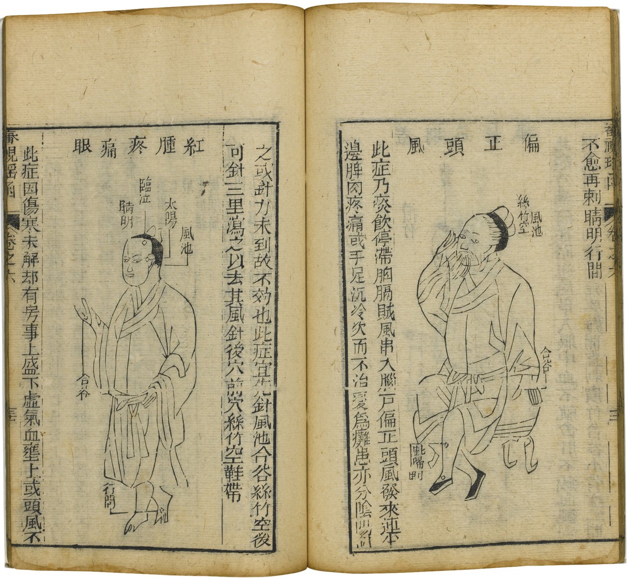 Shen Shi Yao Han Un libro precioso de oftalmología, 1644 de Fu Renyu