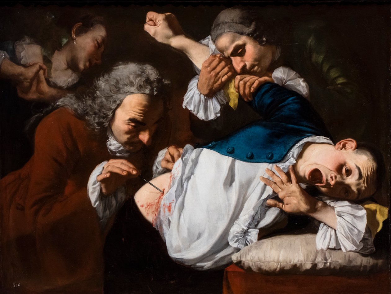 La operación, hacia 1753/54 (Óleo sobre lienzo) de Gaspare Traversi