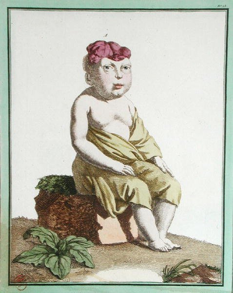 Niño con media cabeza, de 