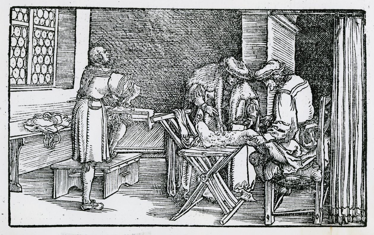 El tratamiento de una pierna gangrenada de German School