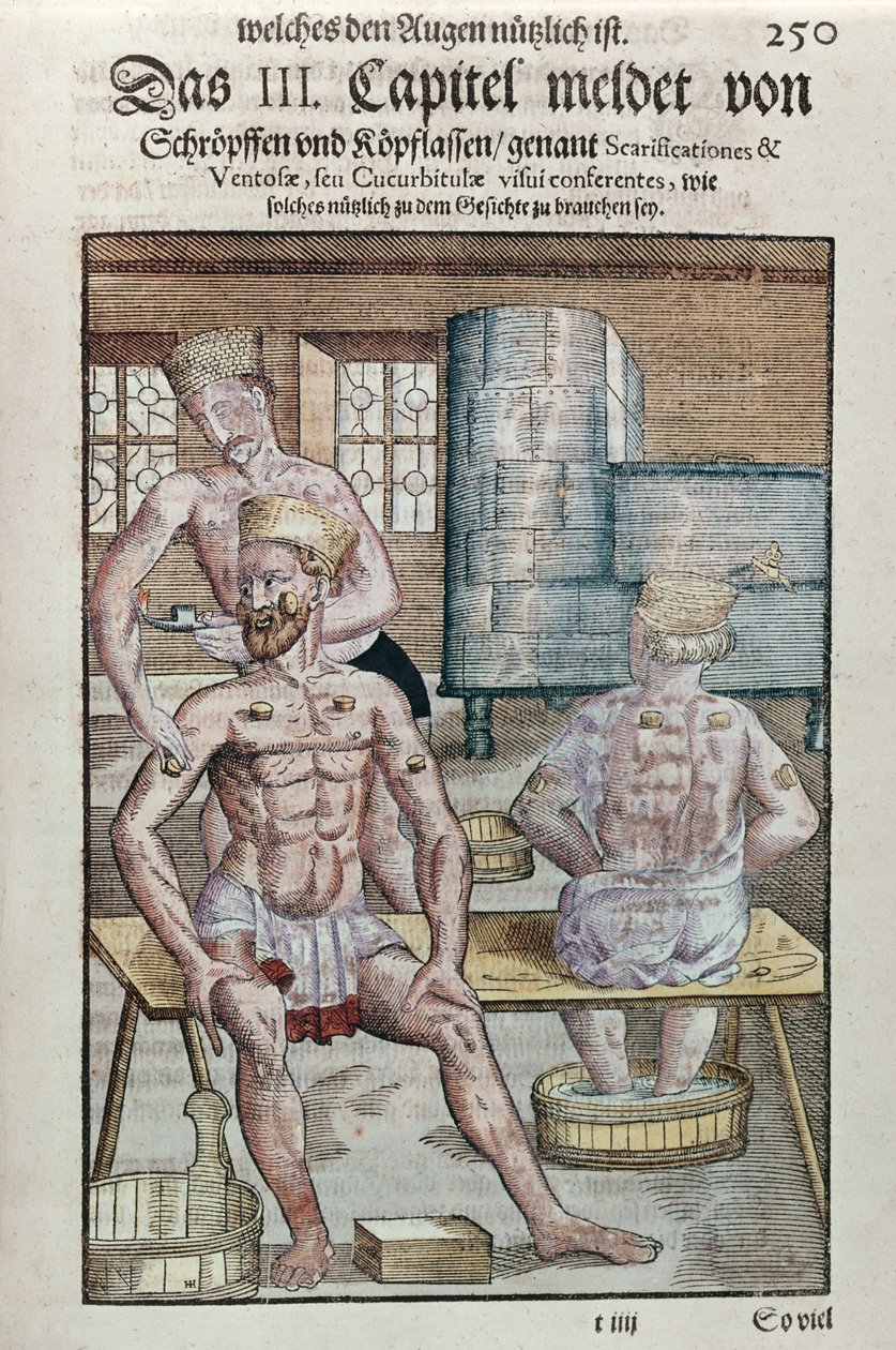 Ventosas, de Ophthalmodouleia por Georg Bartisch (1535-1636) publicado en Dresde en 1583 de German School