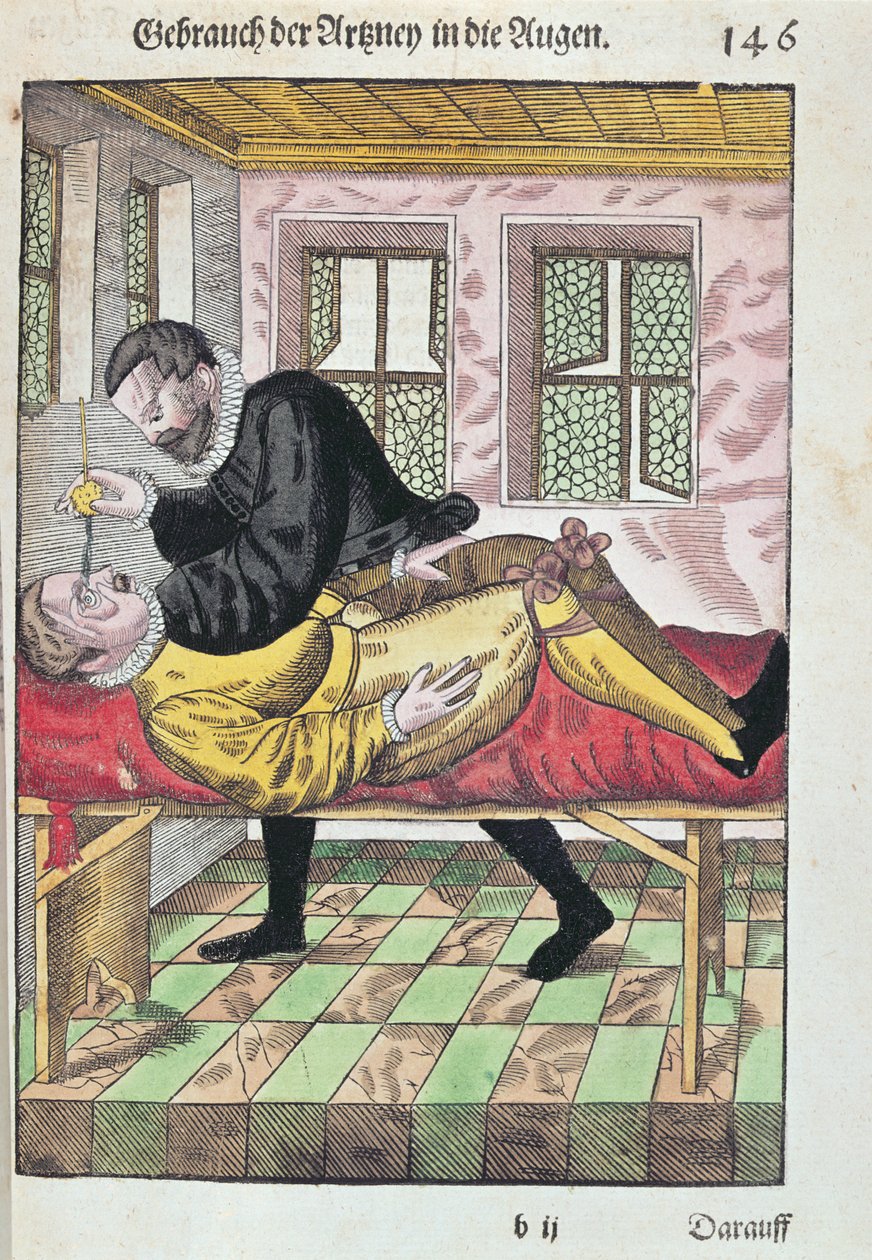 Operación de Ojo, de Ophthalmodouleia por Georg Bartisch (1535-1636) publicado en Dresde en 1583 (xilografía en color) de German School