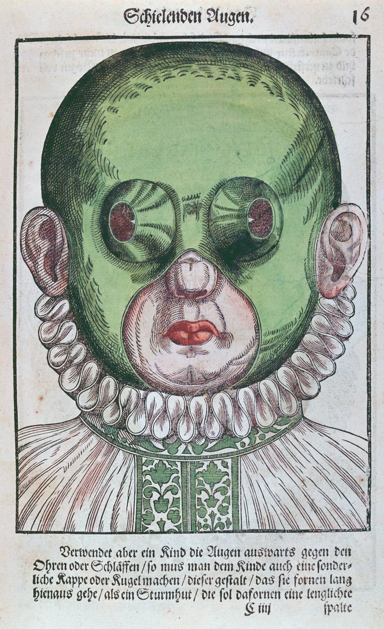 Máscara para tratar un estrabismo, de Ophthalmodouleia por Georg Bartisch (1535-1636) publicado en Dresde en 1583 de German School