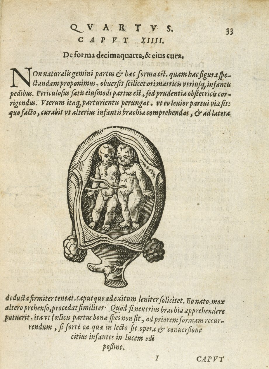 Gemelos no idénticos en el útero, ilustración del capítulo 14, Libro 4 de Sobre la Concepción y el Crecimiento del Hombre por Rueff, 1587 de German School