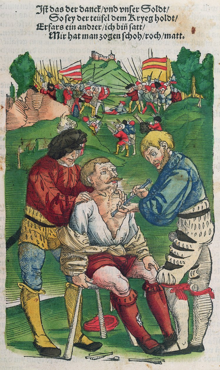 Extracción de una flecha, ilustración de Feldtbuch der Wundartzney por Hans von Gersdorff, 1540 de German School